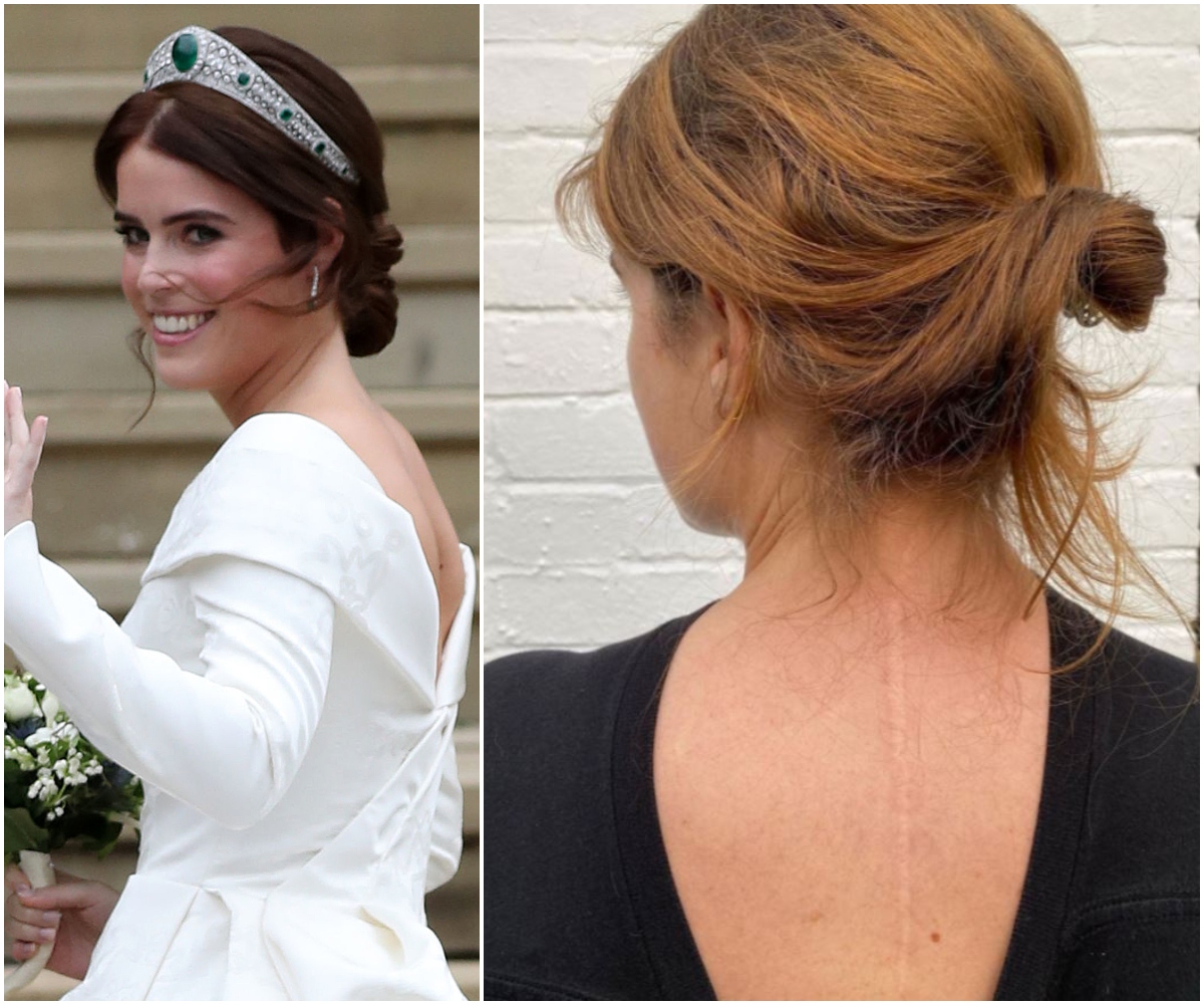 Princess Eugenie shows her scoliosis scar in her most raw and honest Instagram post yet