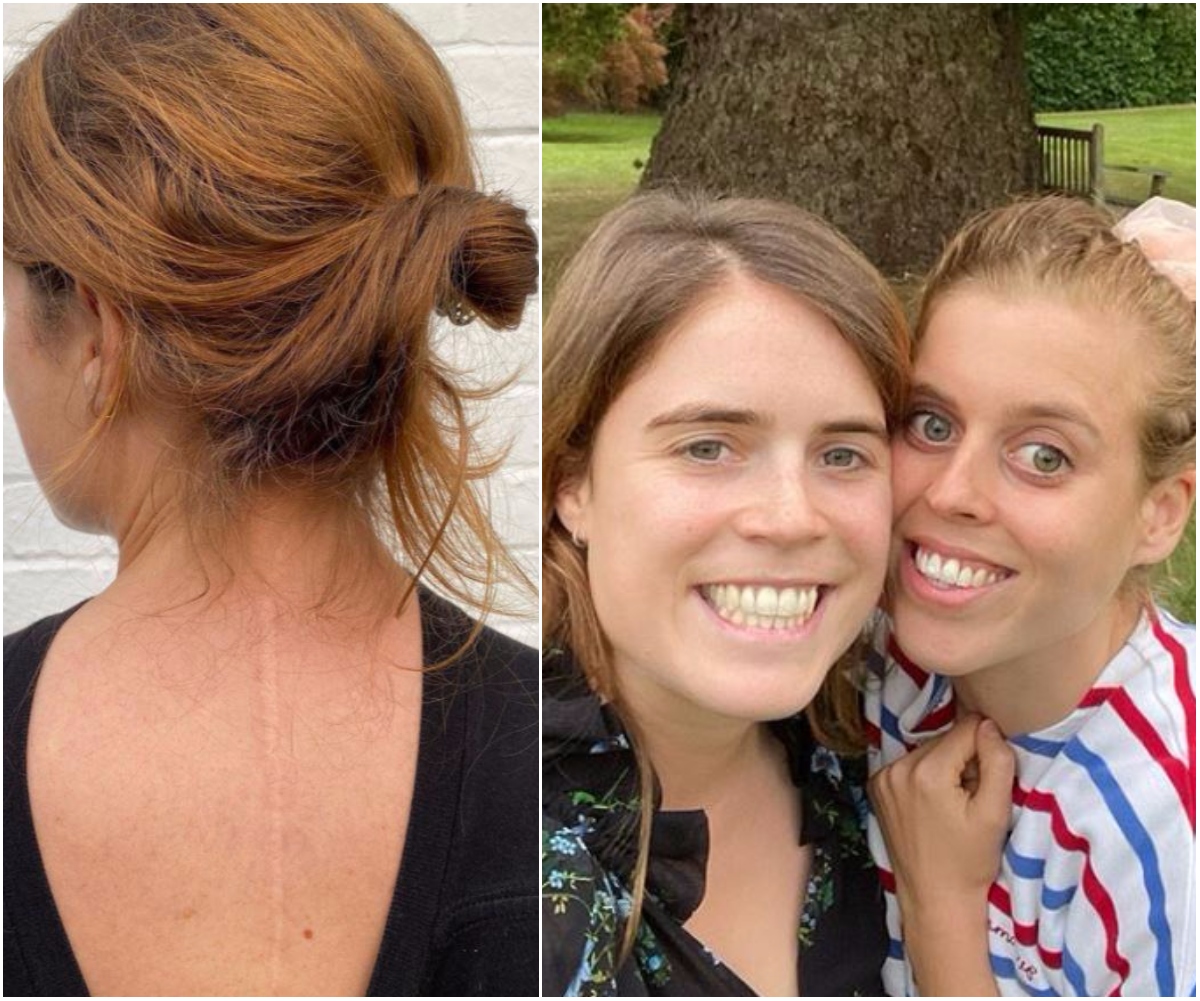 “Scars are beautiful”: Princess Eugenie shares a rare & raw picture with fans in a unique throwback Thursday twist