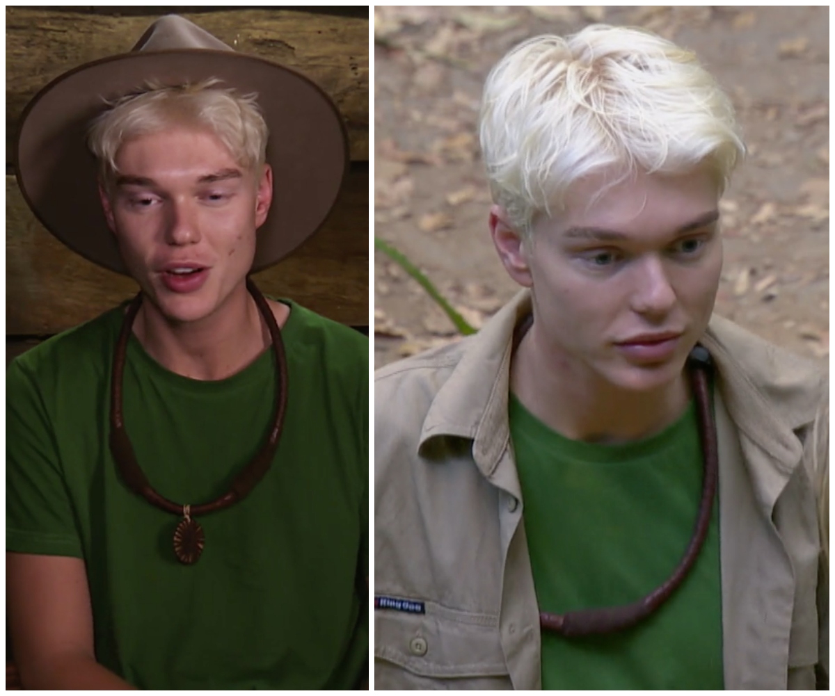 EXCLUSIVE CLIP: Jack Vidgen shares the truth about his cosmetic surgery in a tense conversation on I’m A Celebrity