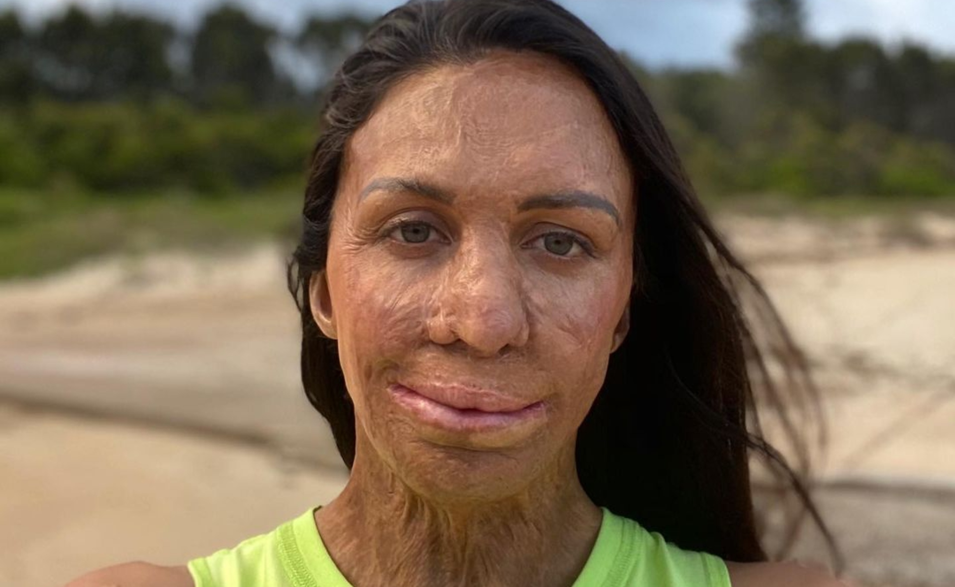Turia Pitt is breaking down BS beauty standards – her groundbreaking new move is case in point