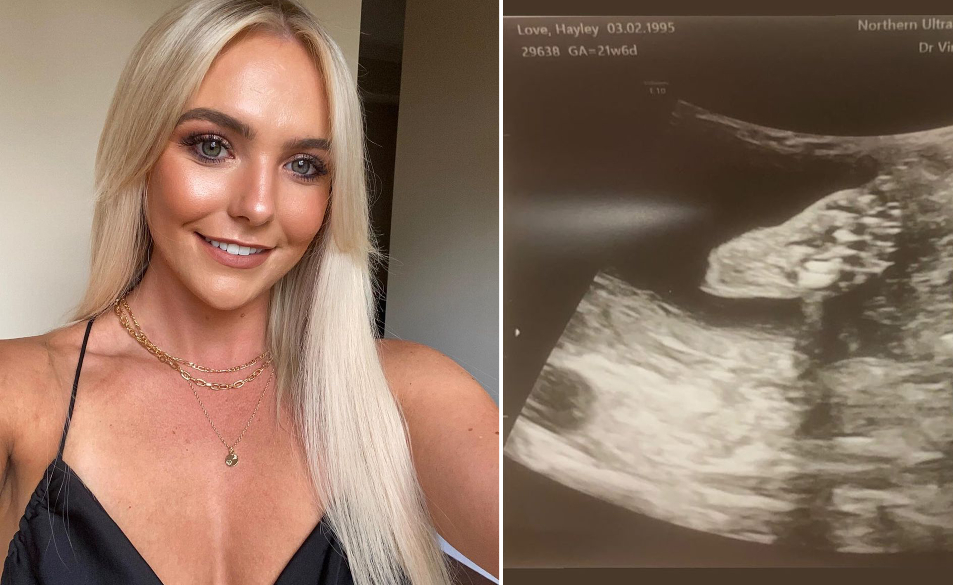 Farmer Wants A Baby! Hayley reveals that she is pregnant with Farmer Will’s child