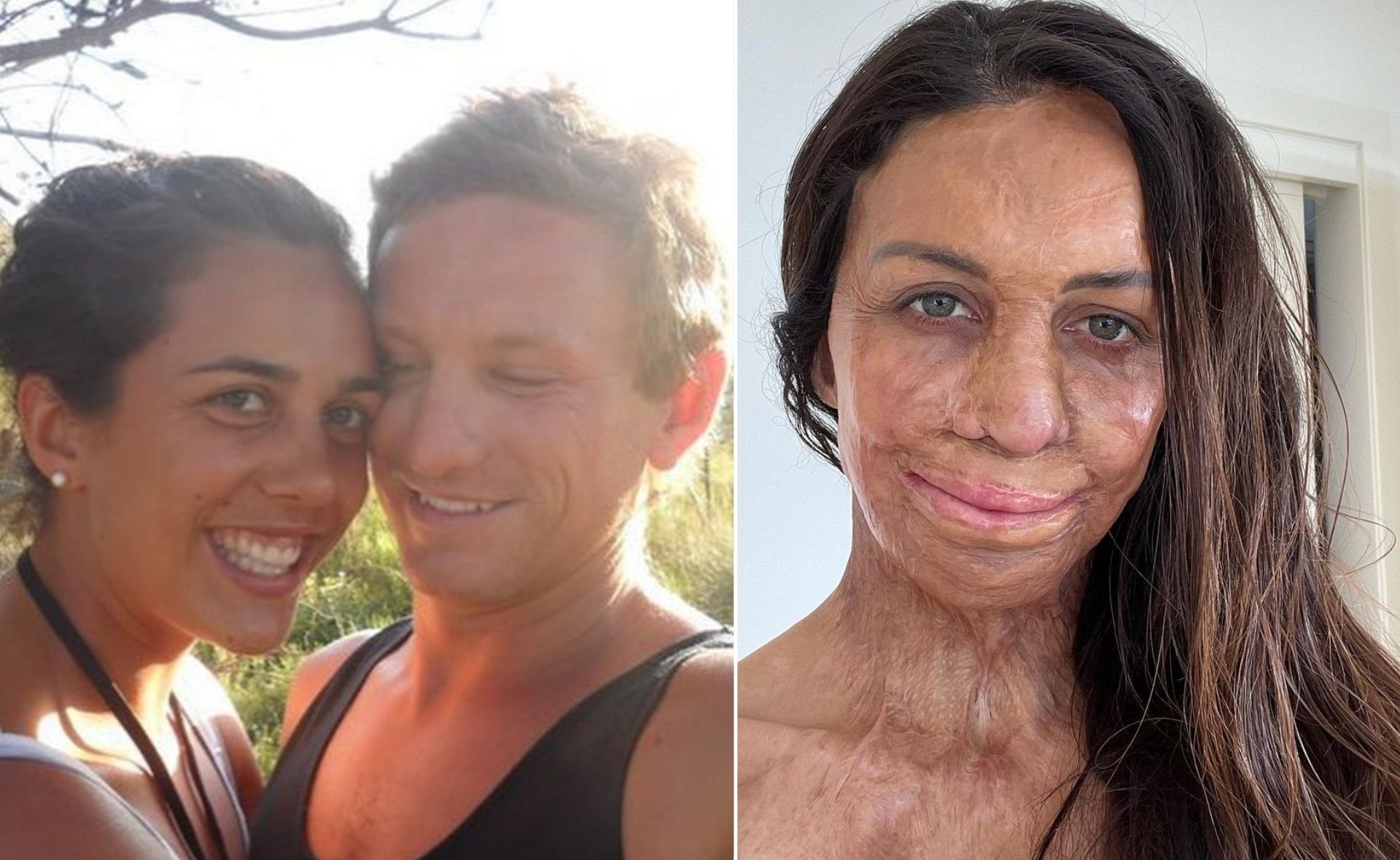 “This is what I remember”: Turia Pitt marks 10 years since the bushfire that changed her life