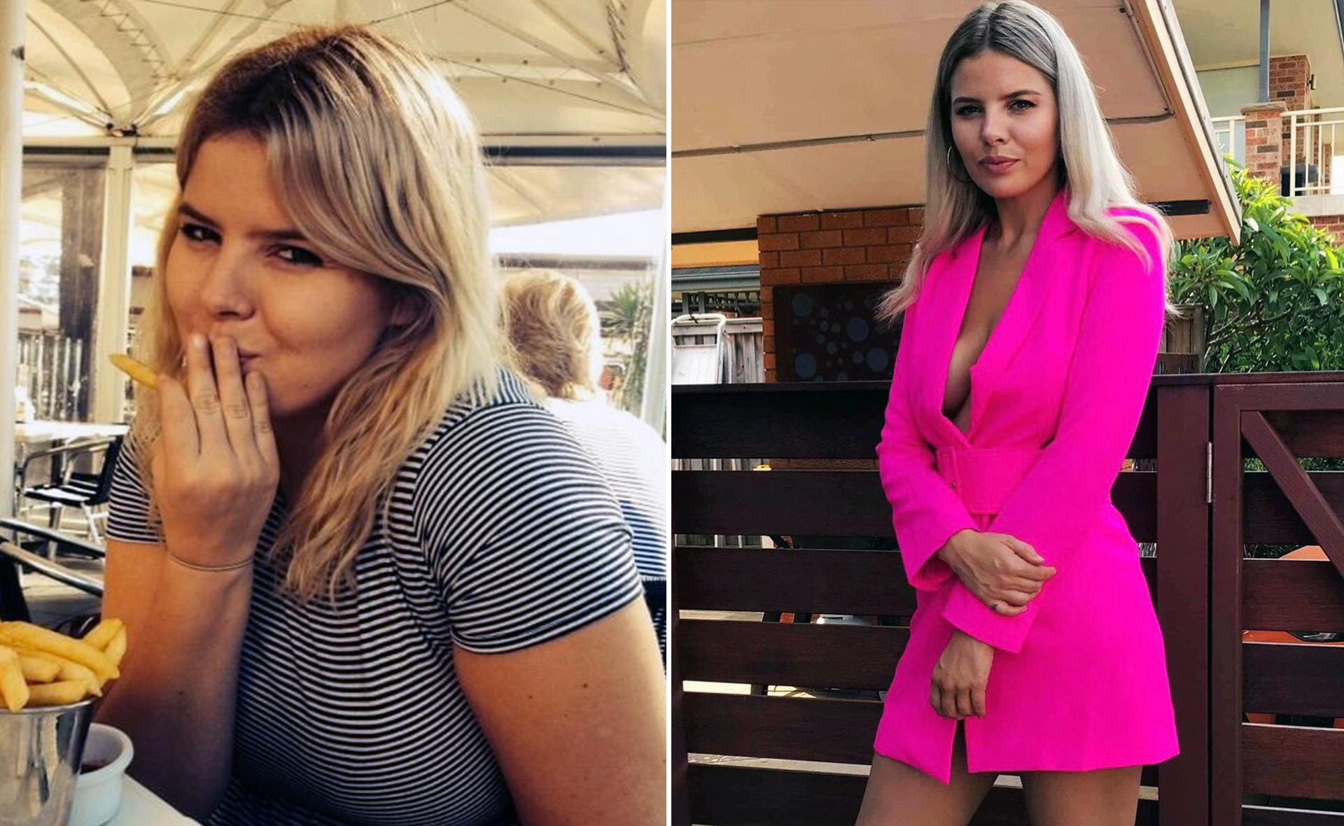 EXCLUSIVE: Married At First Sight’s Olivia Frazer lost 25 kilos after surgery that transformed her life