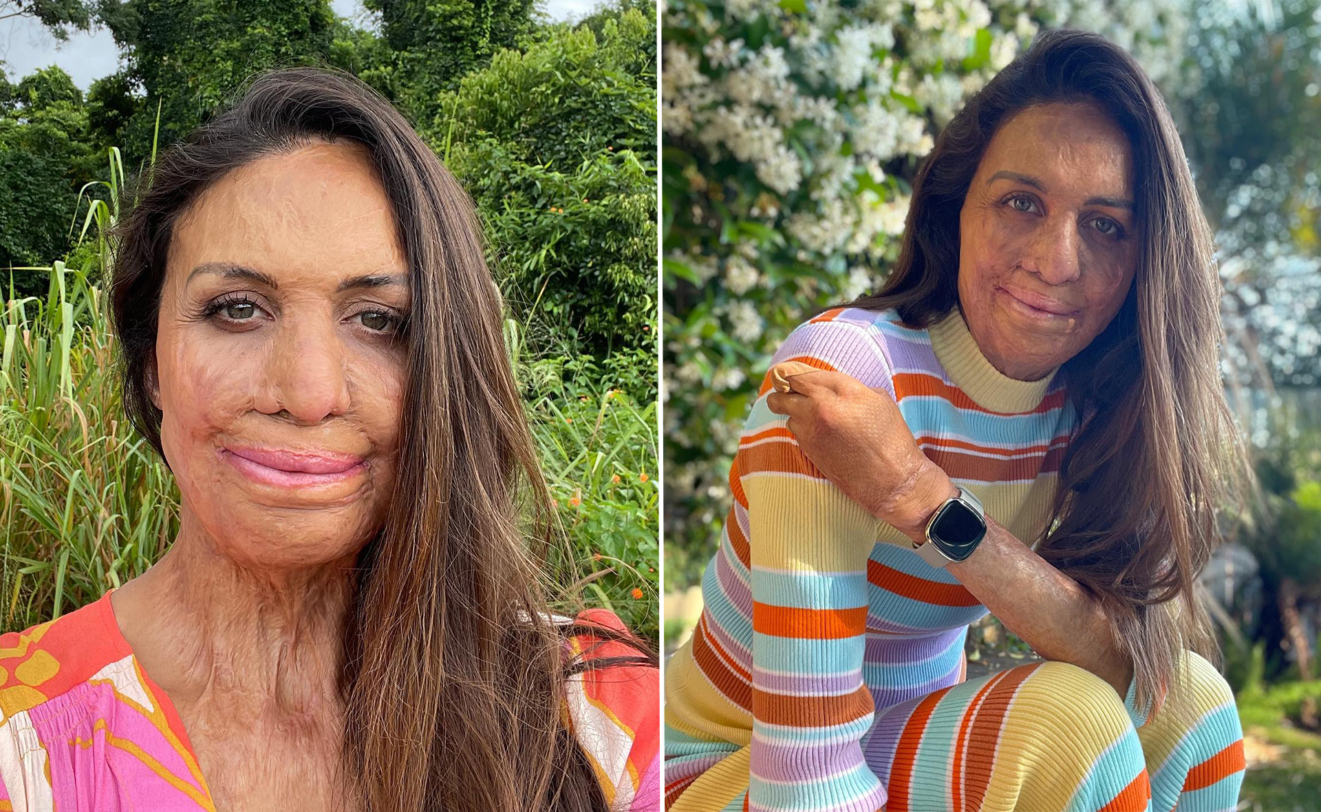 Turia Pitt’s touching message of hope to those affected by floods and the war in Ukraine