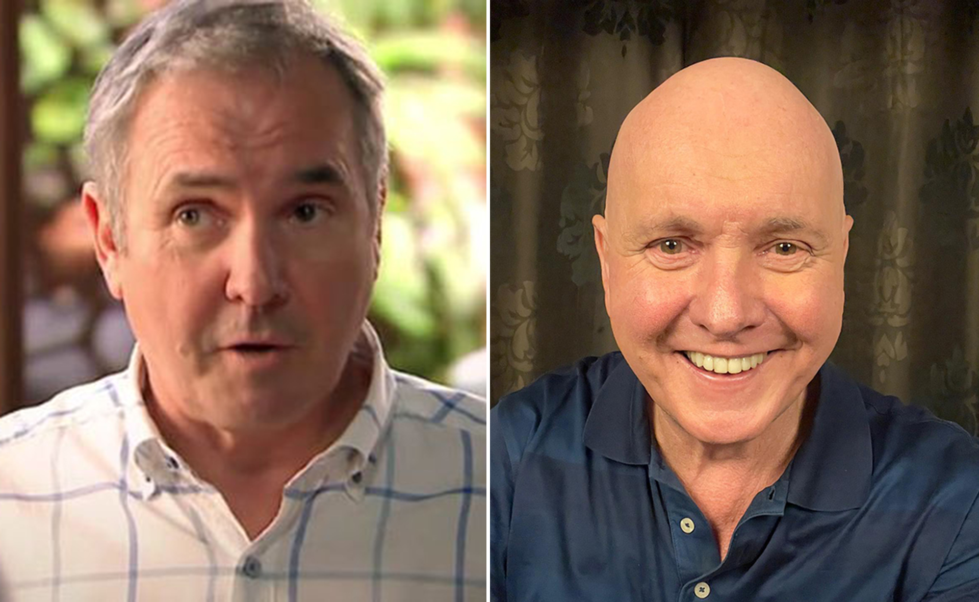 How Neighbours veteran Alan Fletcher is encouraging others with Alopecia to be unfazed by hair loss