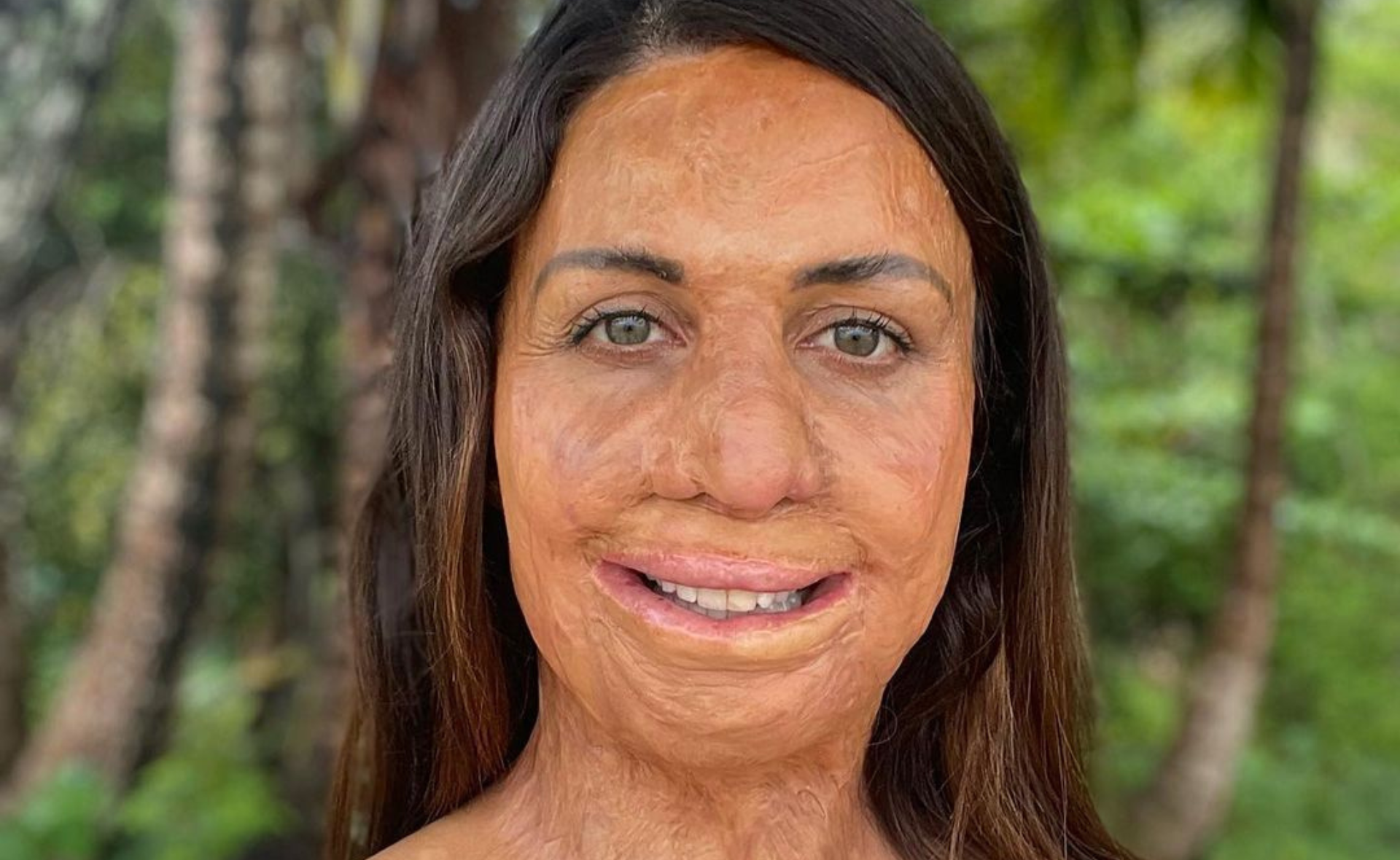 Turia Pitt confesses she was distraught after finding “confronting” images taken days after the fire