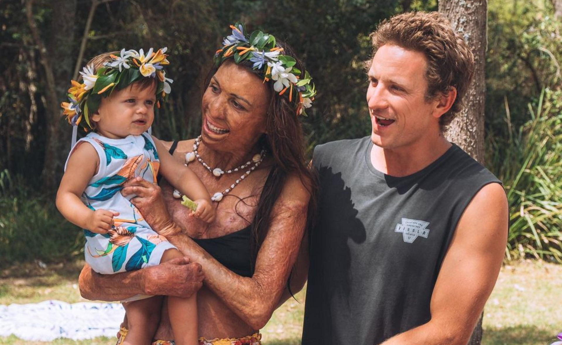Turia Pitt reveals she’s recovering from a nose reconstruction surgery