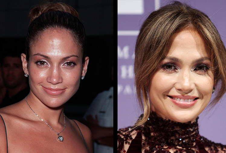 J.Lo: I’ve never had plastic surgery!