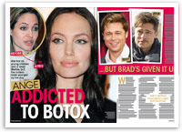 Angelina Jolie: Addicted to Botox