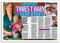 Australia’s tiniest baby survives