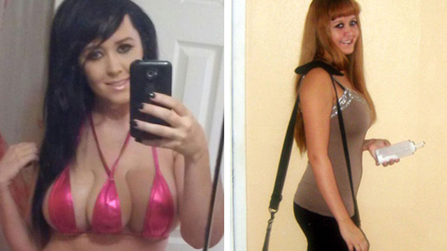 Tampa Woman Adds Third Breast To Be 'Unattractive