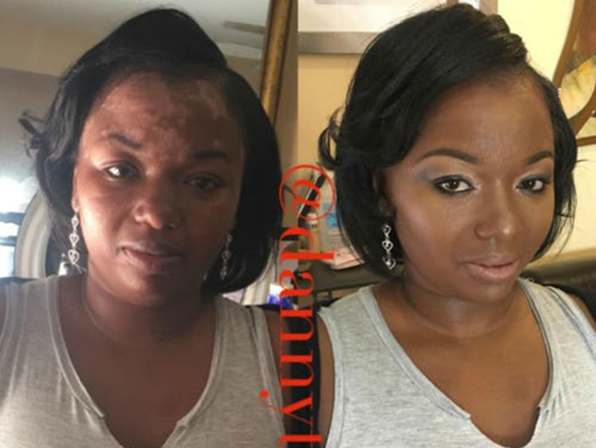 How to use makeup to cover psoriasis, eczema, rosacea