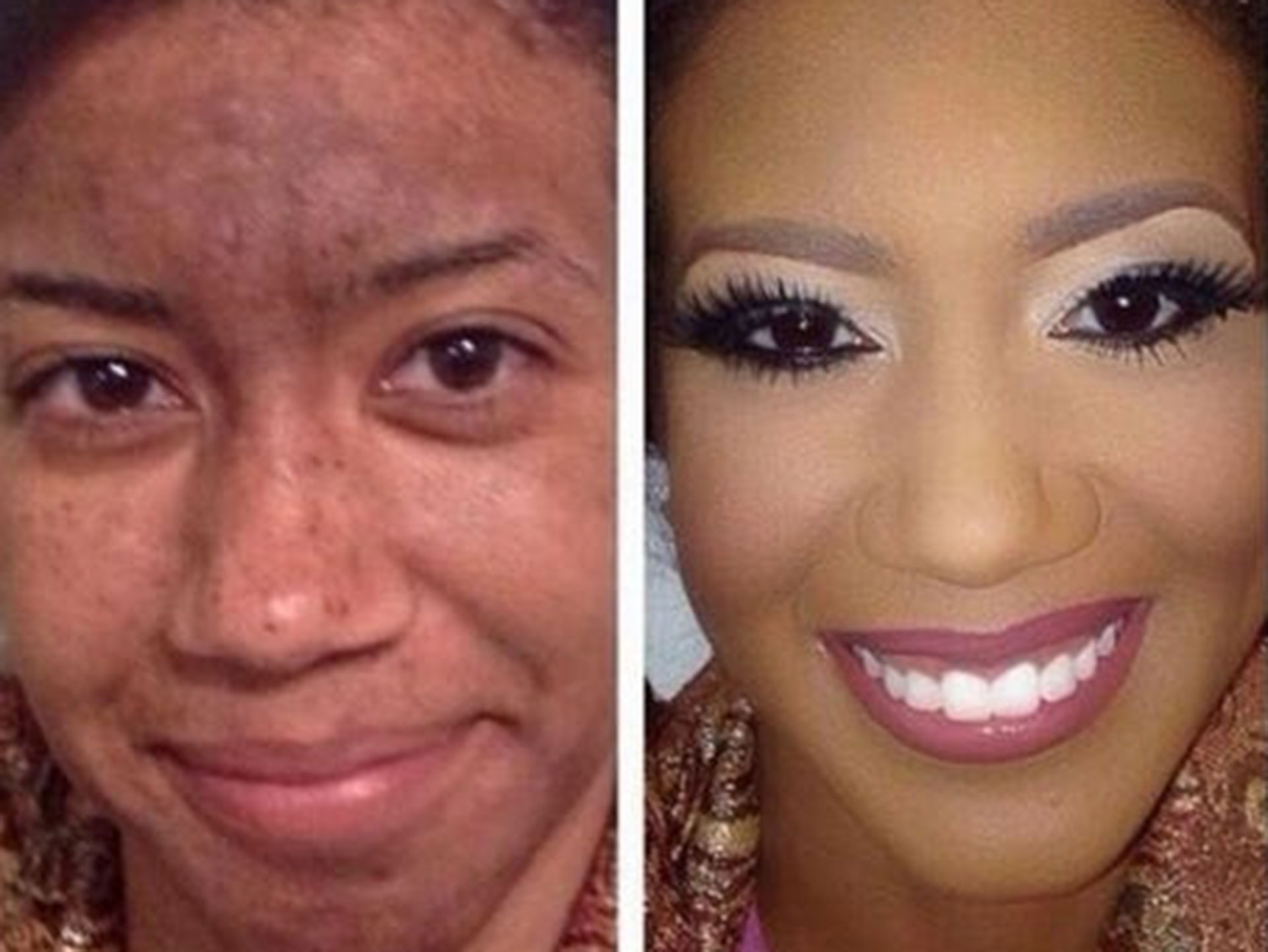 How to use makeup to cover psoriasis, eczema, rosacea